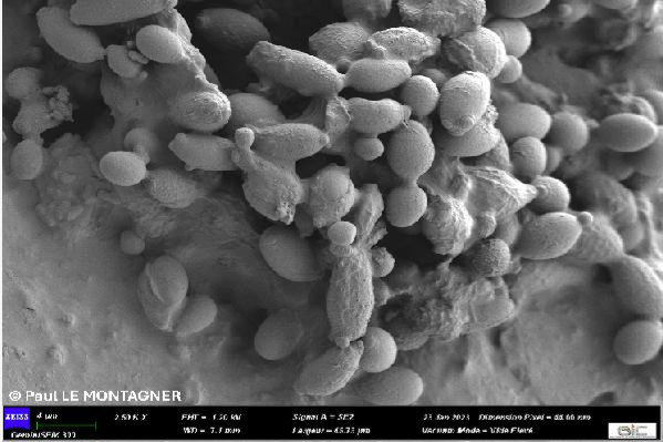 Même le tartre peut en héberger, les Bretts se nichent partout !