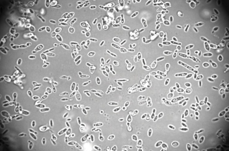 New bio-protection yeast strain kills Brettanomyces New bio-protection yeast strain kills Brettanomyces