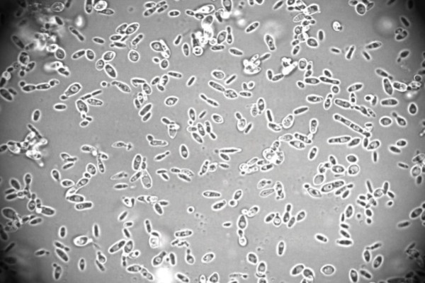 New bio-protection yeast strain kills Brettanomyces