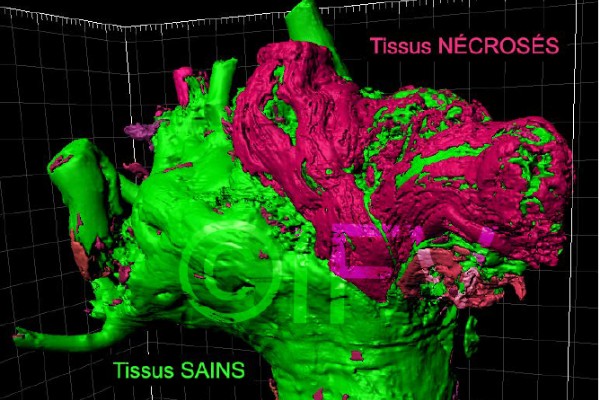 Les maladies du bois scannées au vignoble
