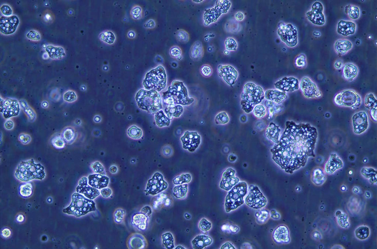 Un nouvel antimildiou en vue pour la vigne