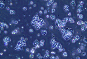 Un nouvel antimildiou en vue pour la vigne