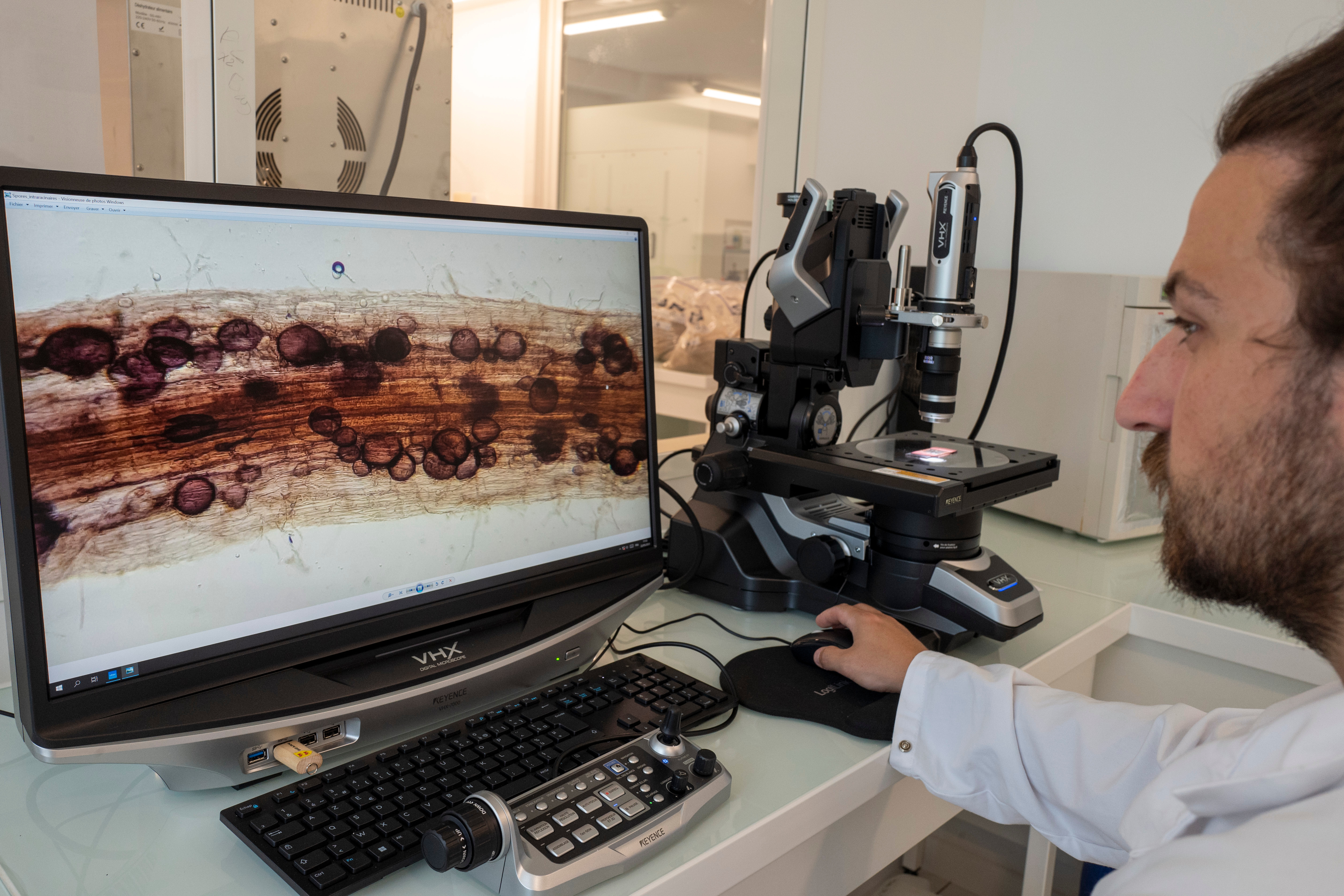 Observationdutauxdemycorhizationduneracinedevigne_MYCOTERROIR.jpg Observationdutauxdemycorhizationduneracinedevigne_MYCOTERROIR.jpg